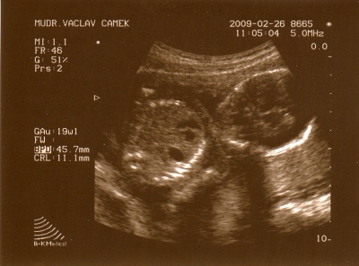 26. 2. 2008