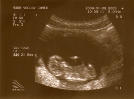 9.1.2008.jpg
